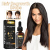 1908903B7993BD00CD5787BD0A96C517 Googeer Hair Regrowth Drops
