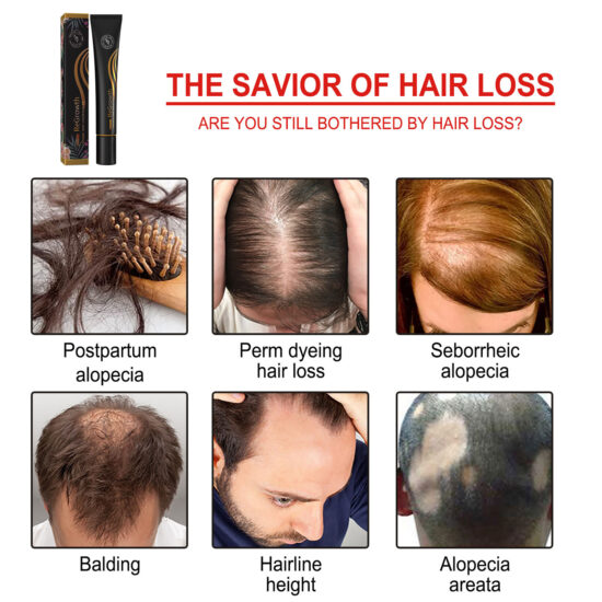 17E075F77F00A3A38B87601F1866E485 EELHOE Hair Lotion with Rolling Ball Massage